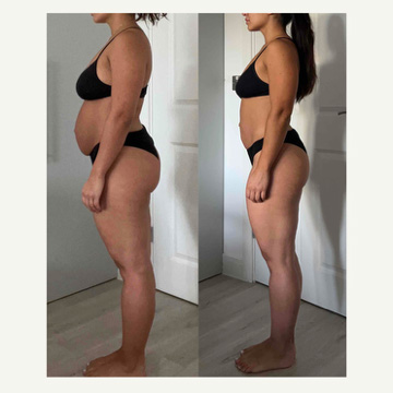transformation-3